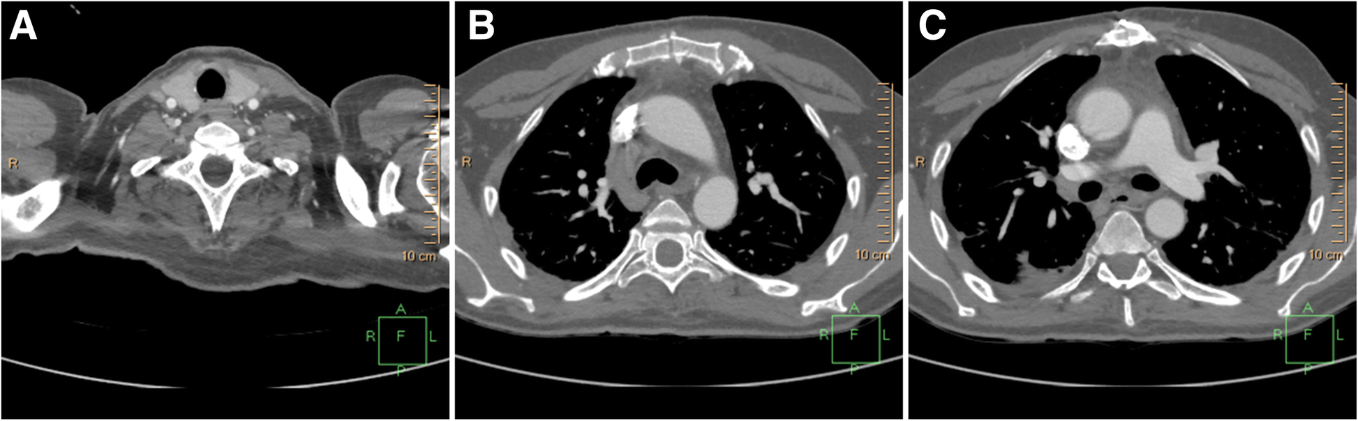 Fig. 5