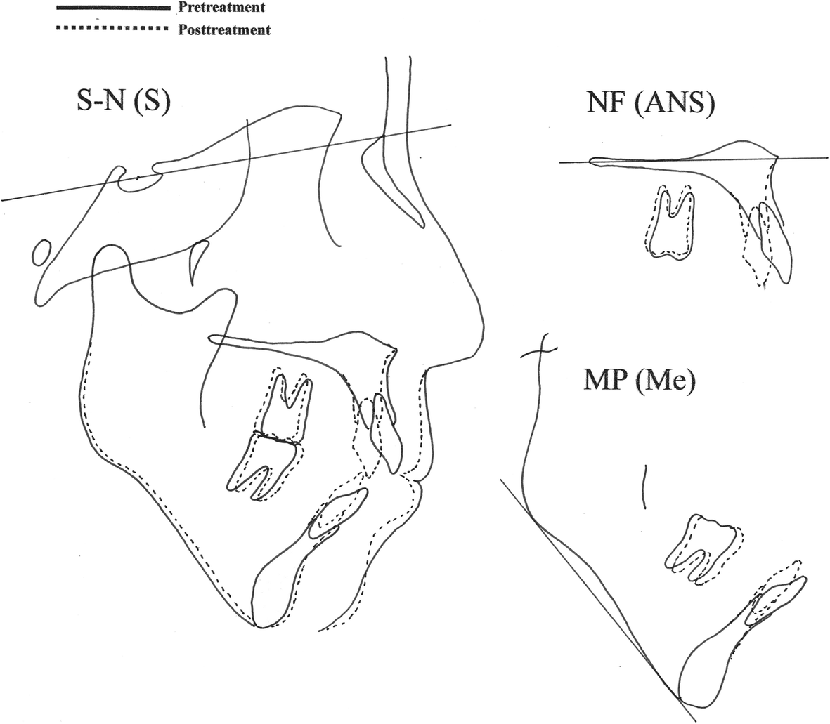 Fig. 11