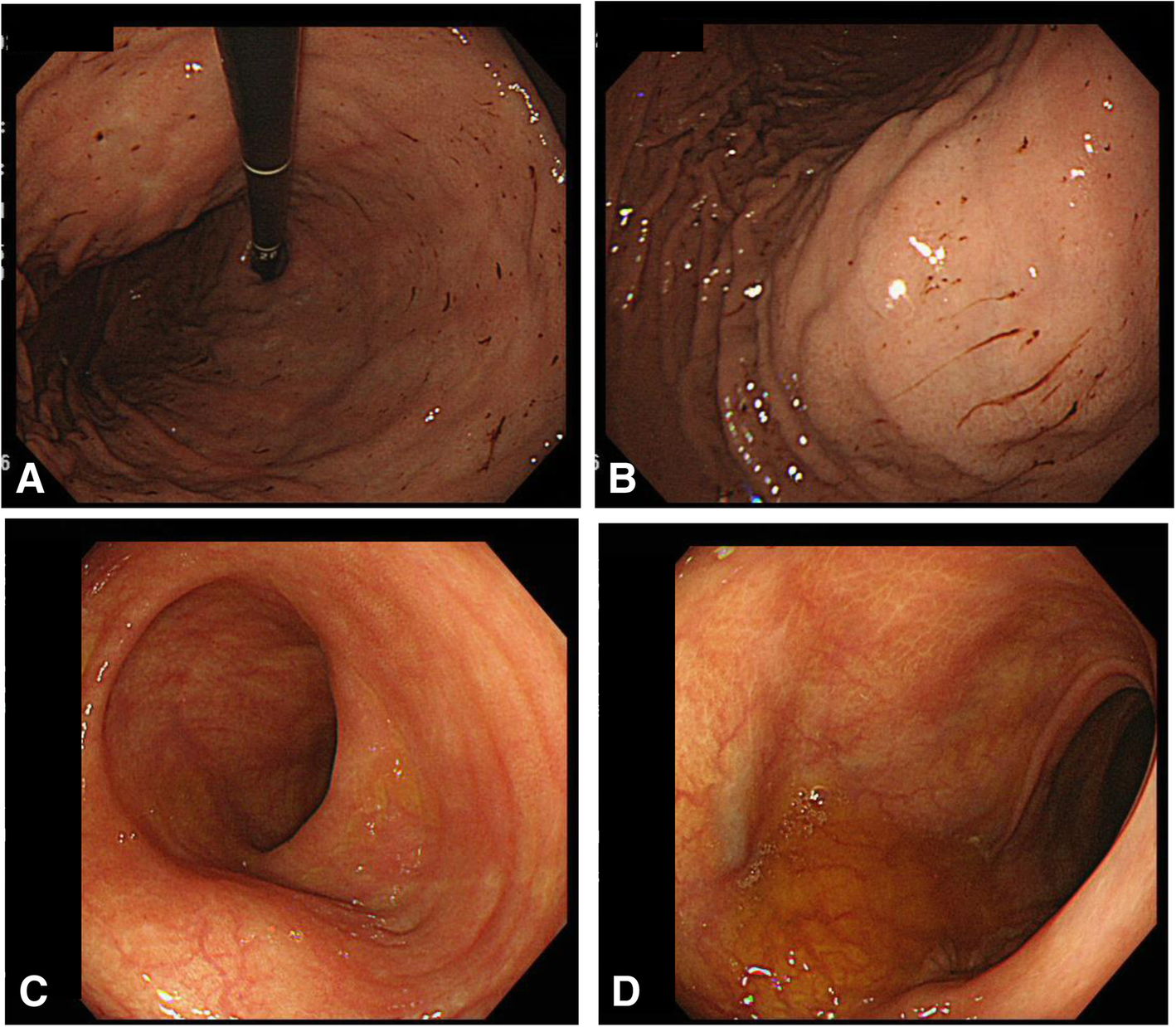 Fig. 5