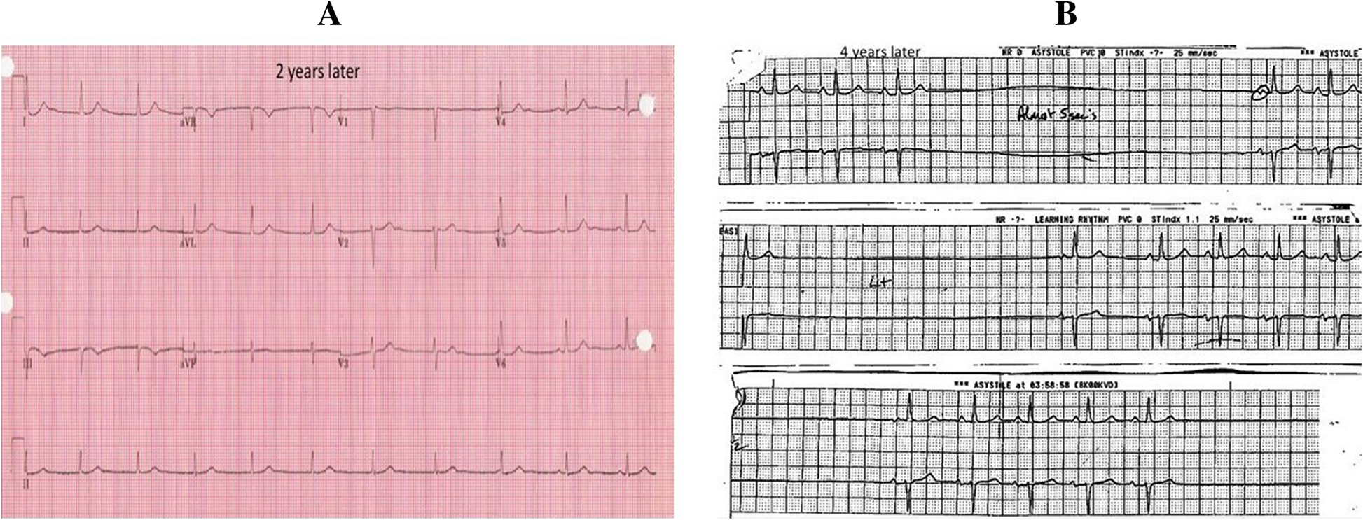 Fig. 4