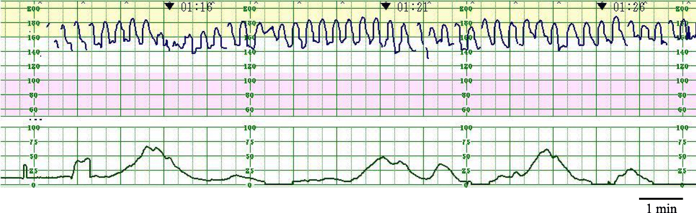 Fig. 1