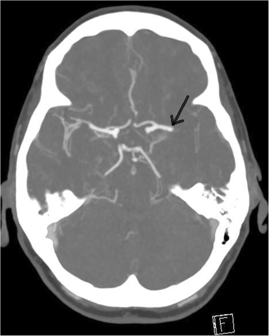 Fig. 1