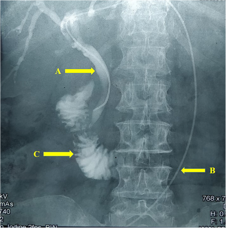 Fig. 1