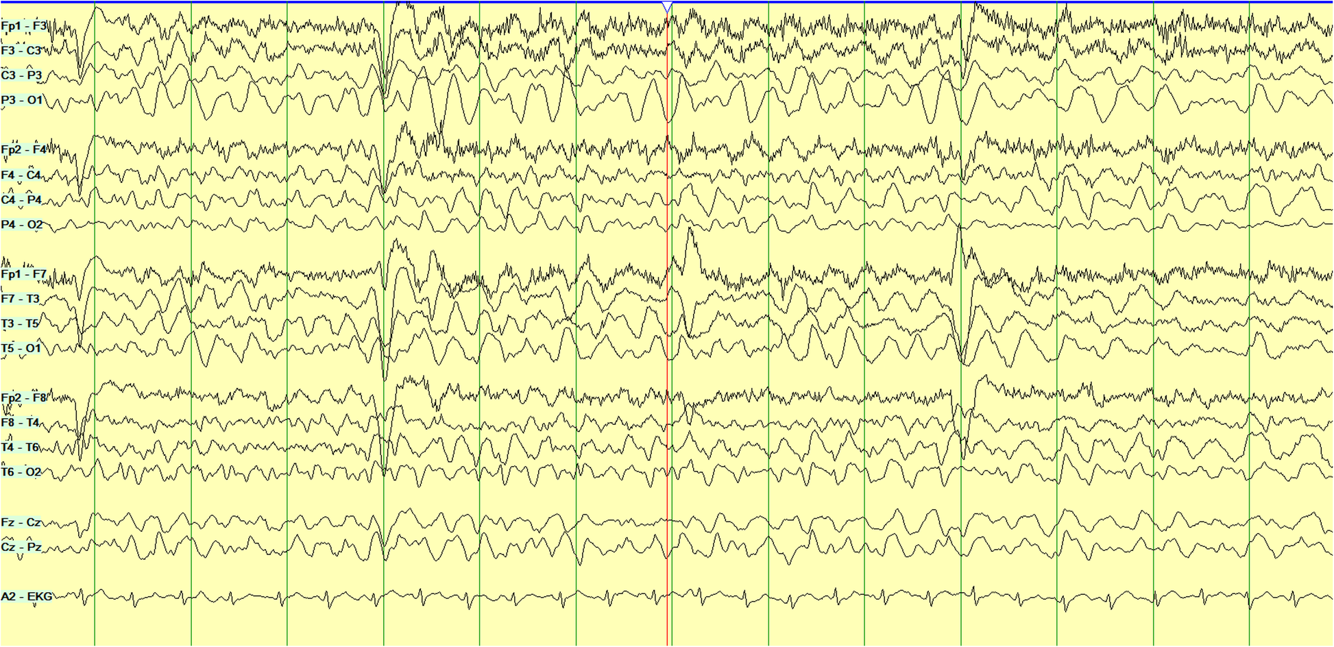 Fig. 6