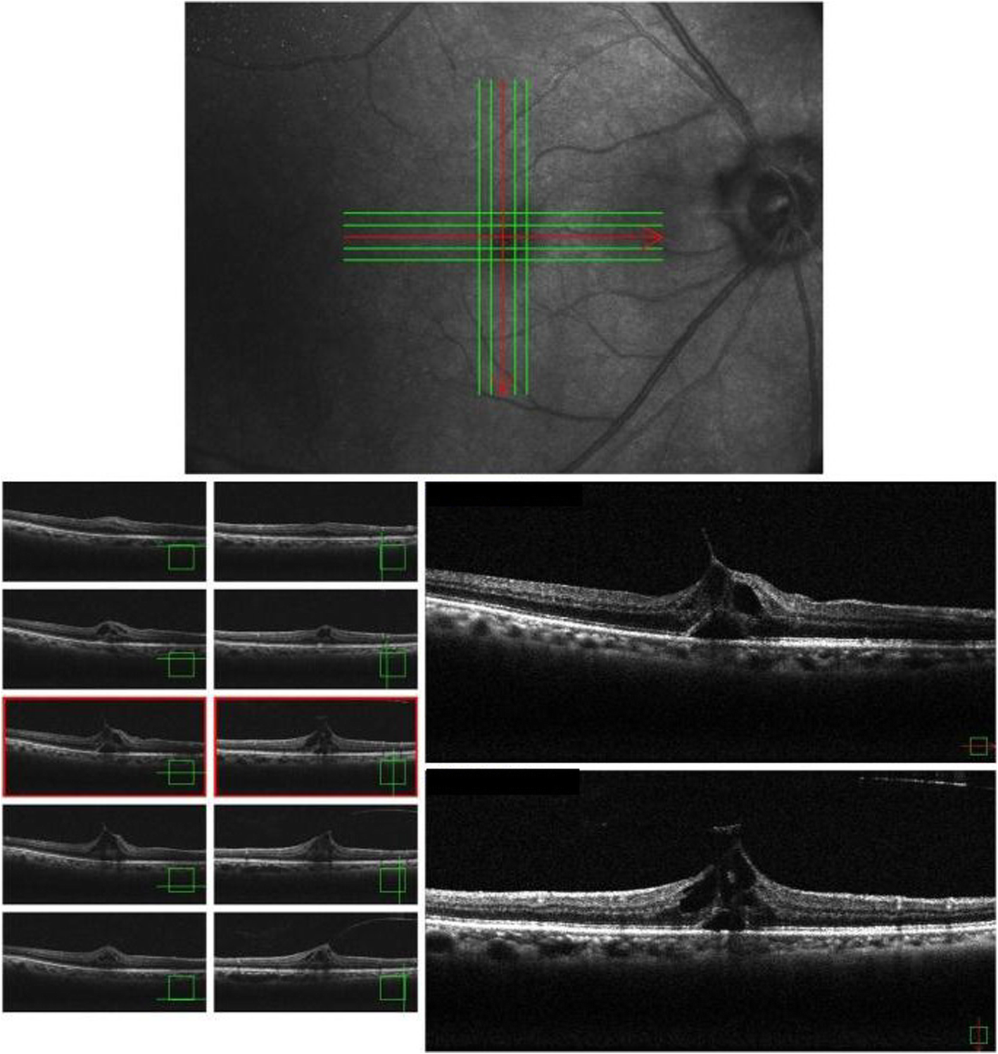 Fig. 1