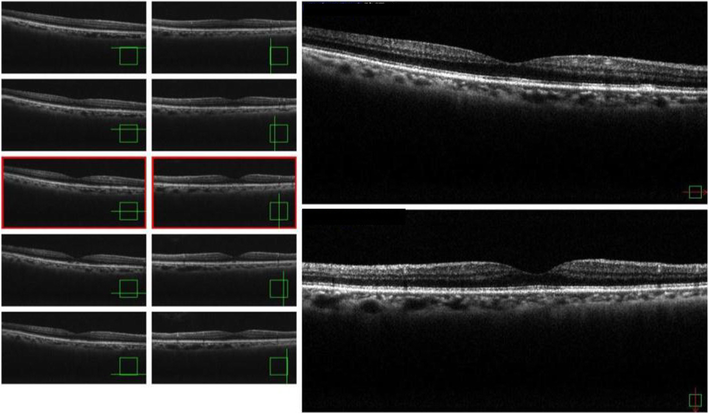 Fig. 3