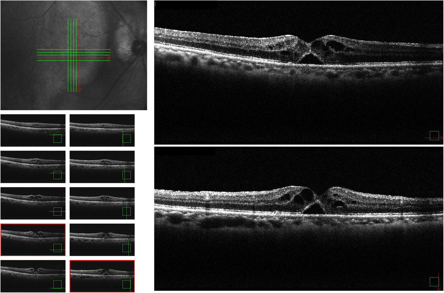 Fig. 4