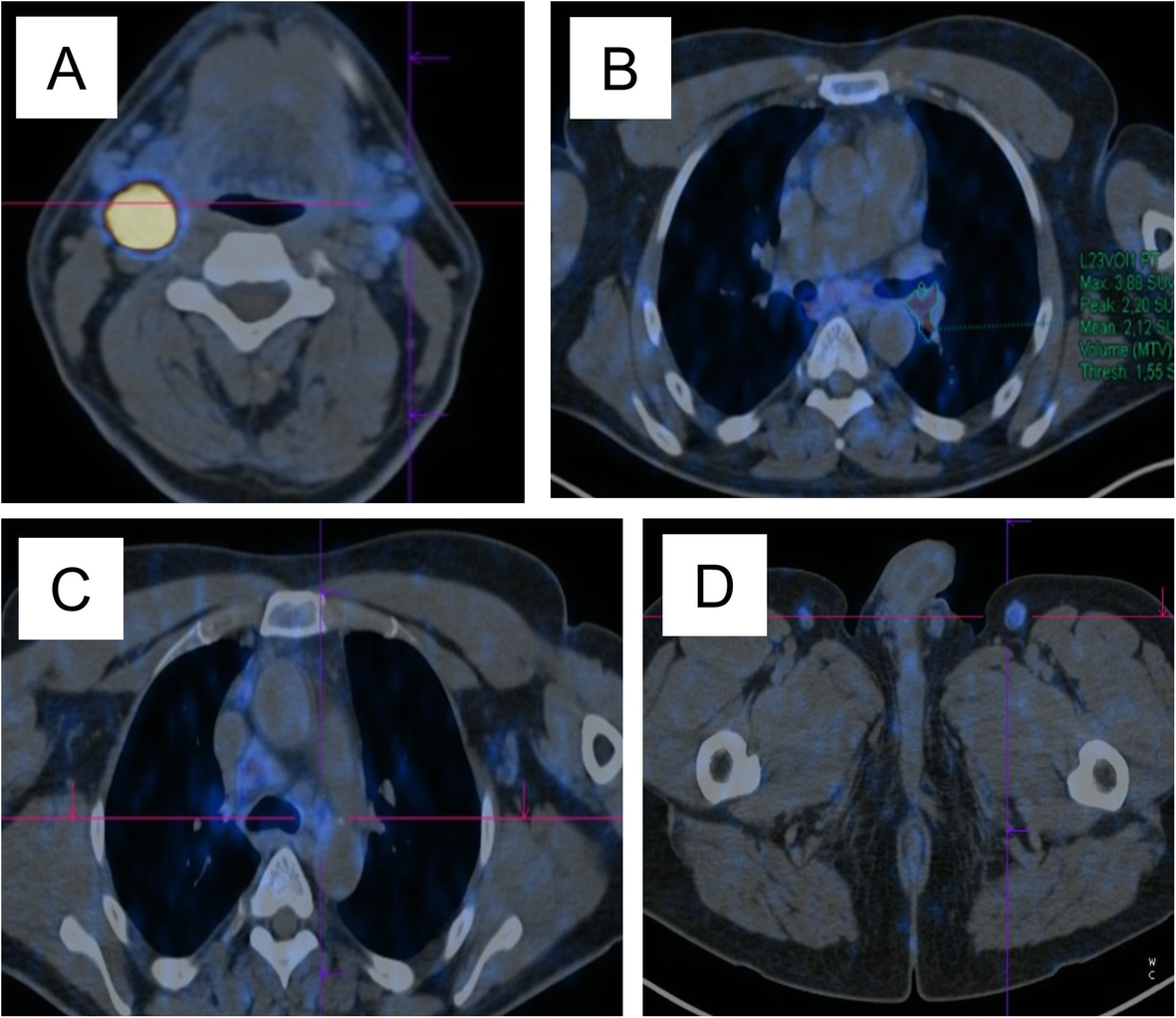 Fig. 3