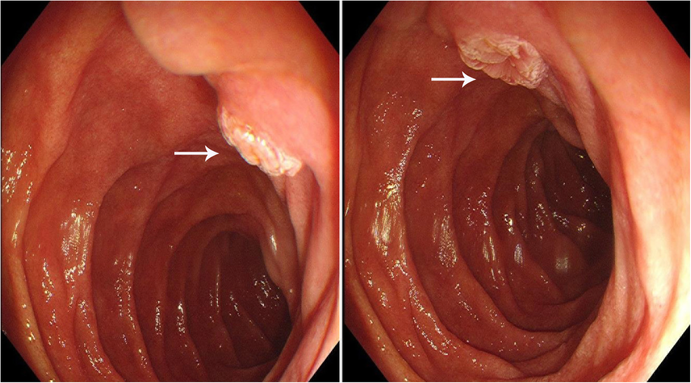 Fig. 2