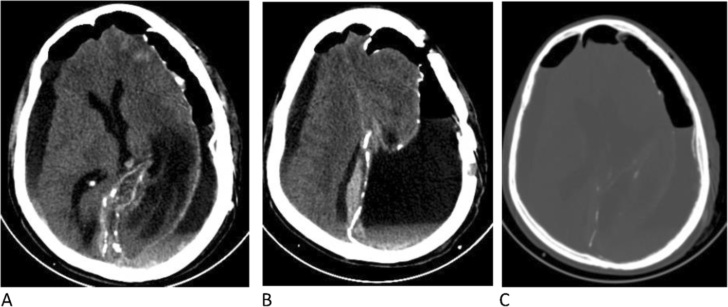 Fig. 5