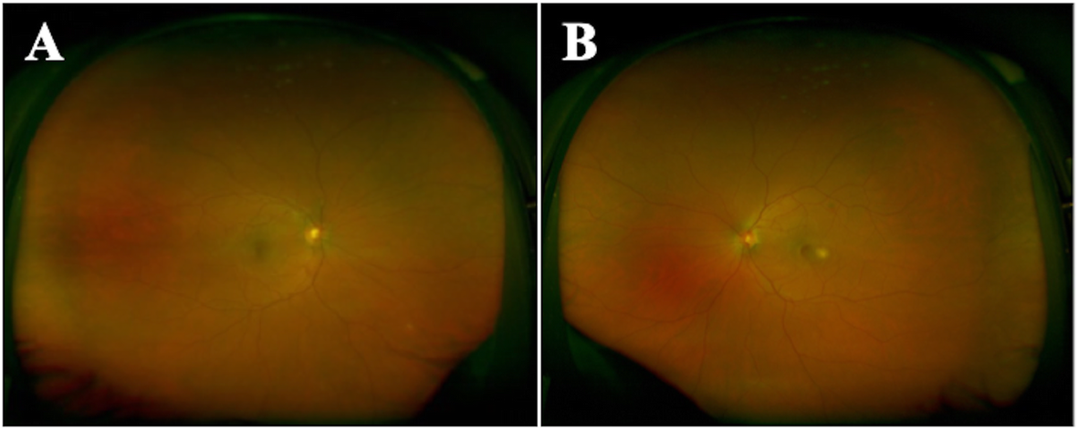 Fig. 1