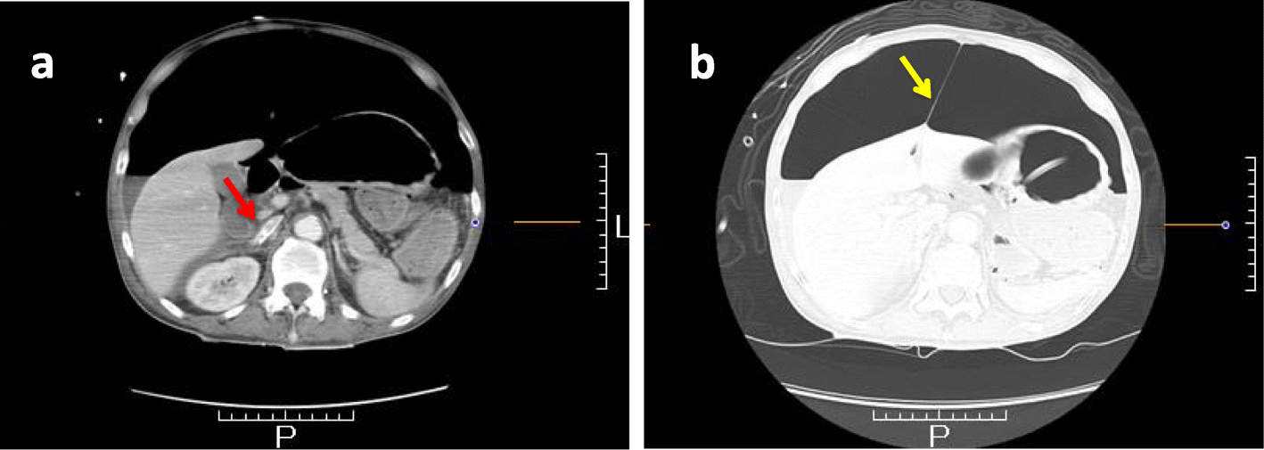 Fig. 2