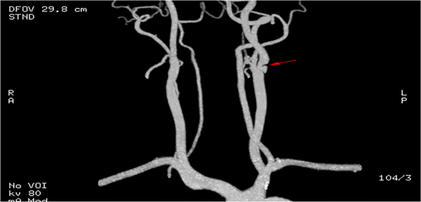 Fig. 10