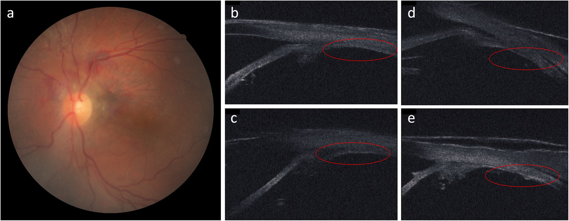 Fig. 6