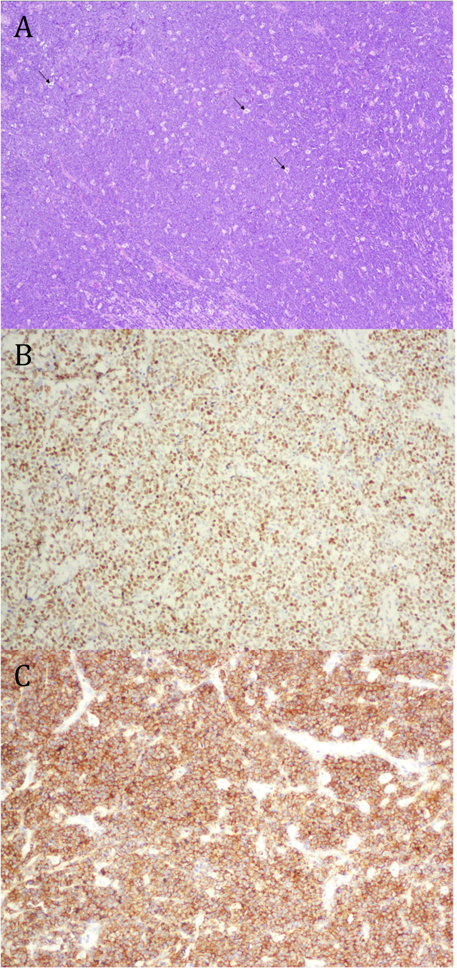 Fig. 2