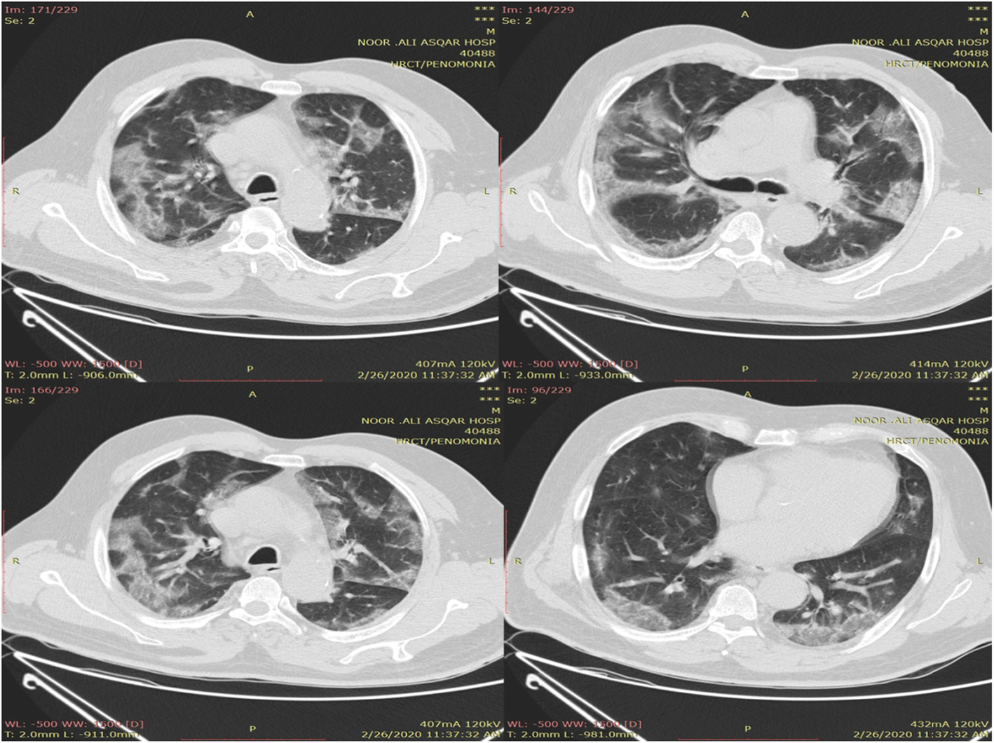 Fig. 1