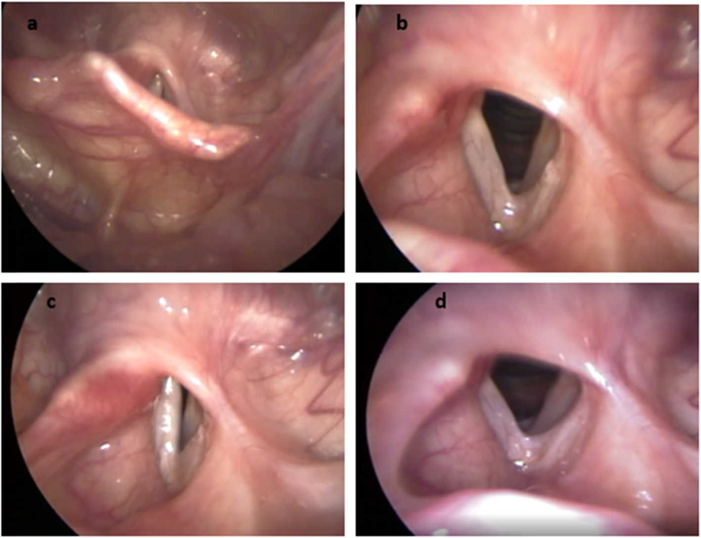 Fig. 4