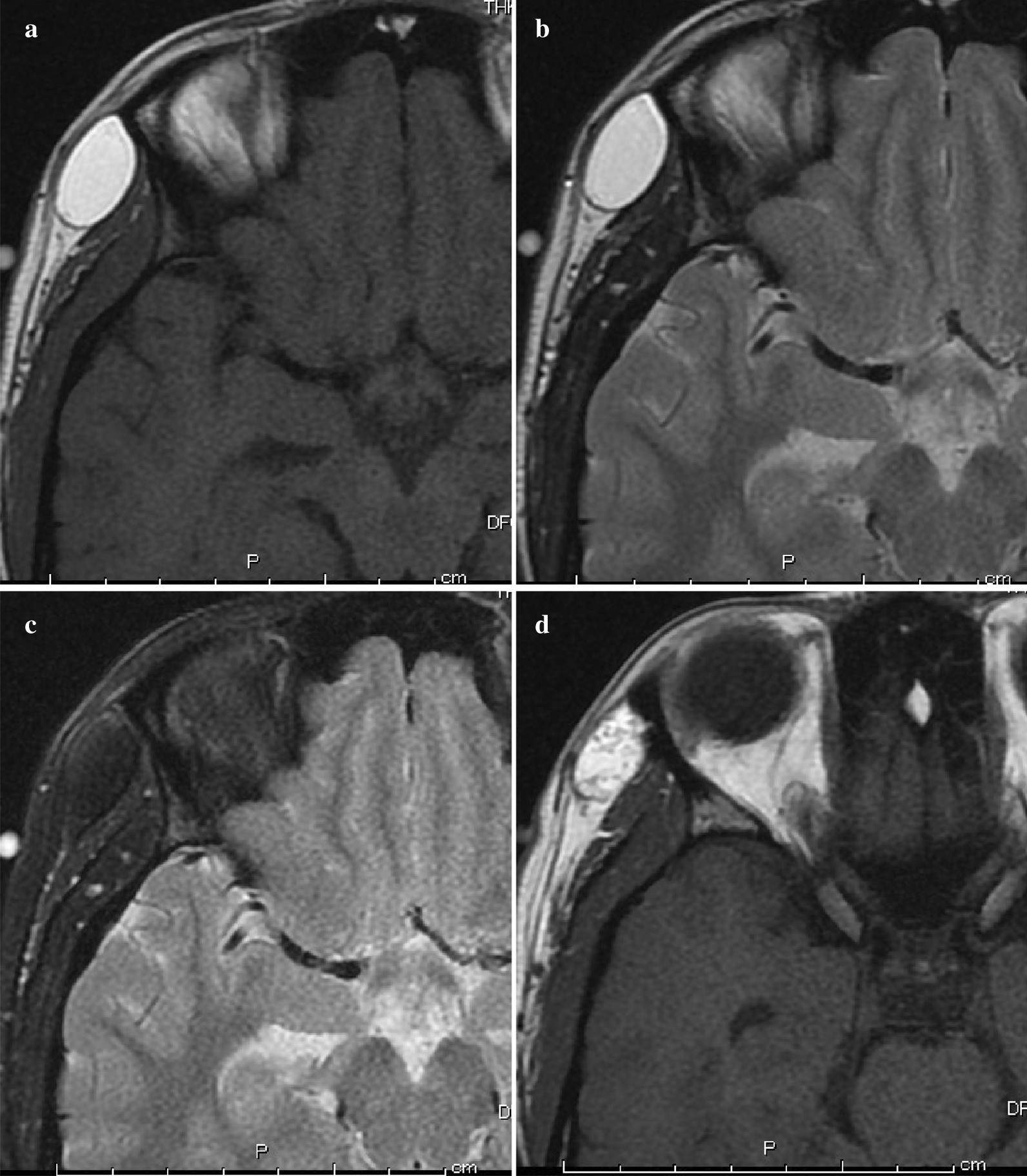 Fig. 2.