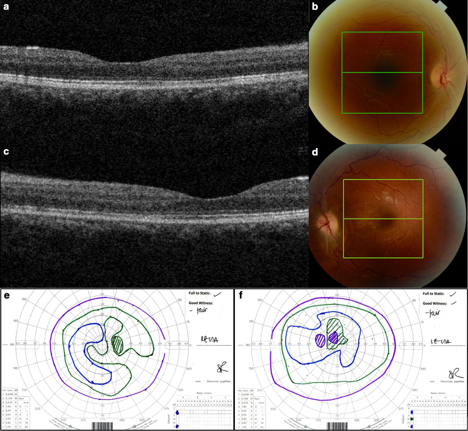 Fig. 4