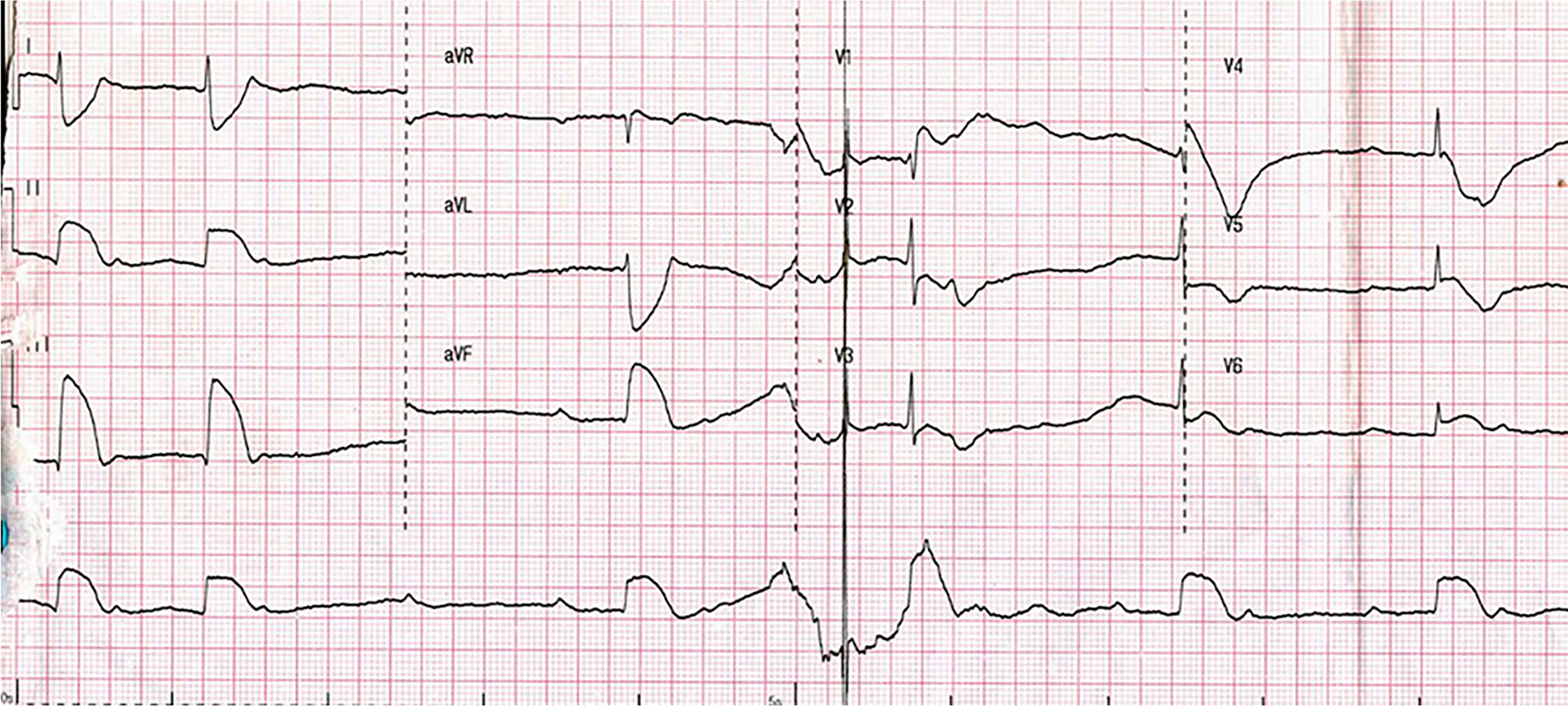 Fig. 2