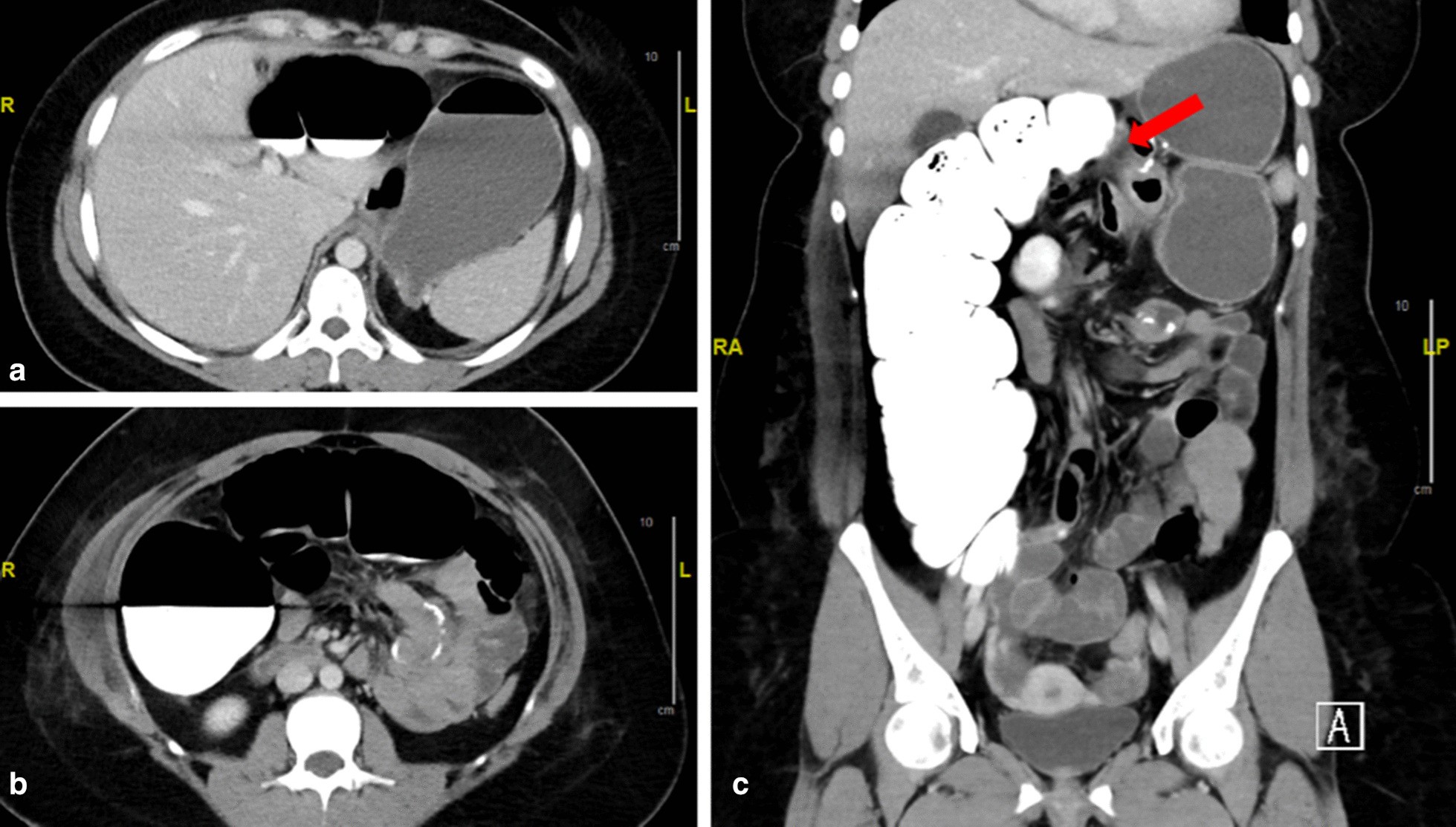 Fig. 1