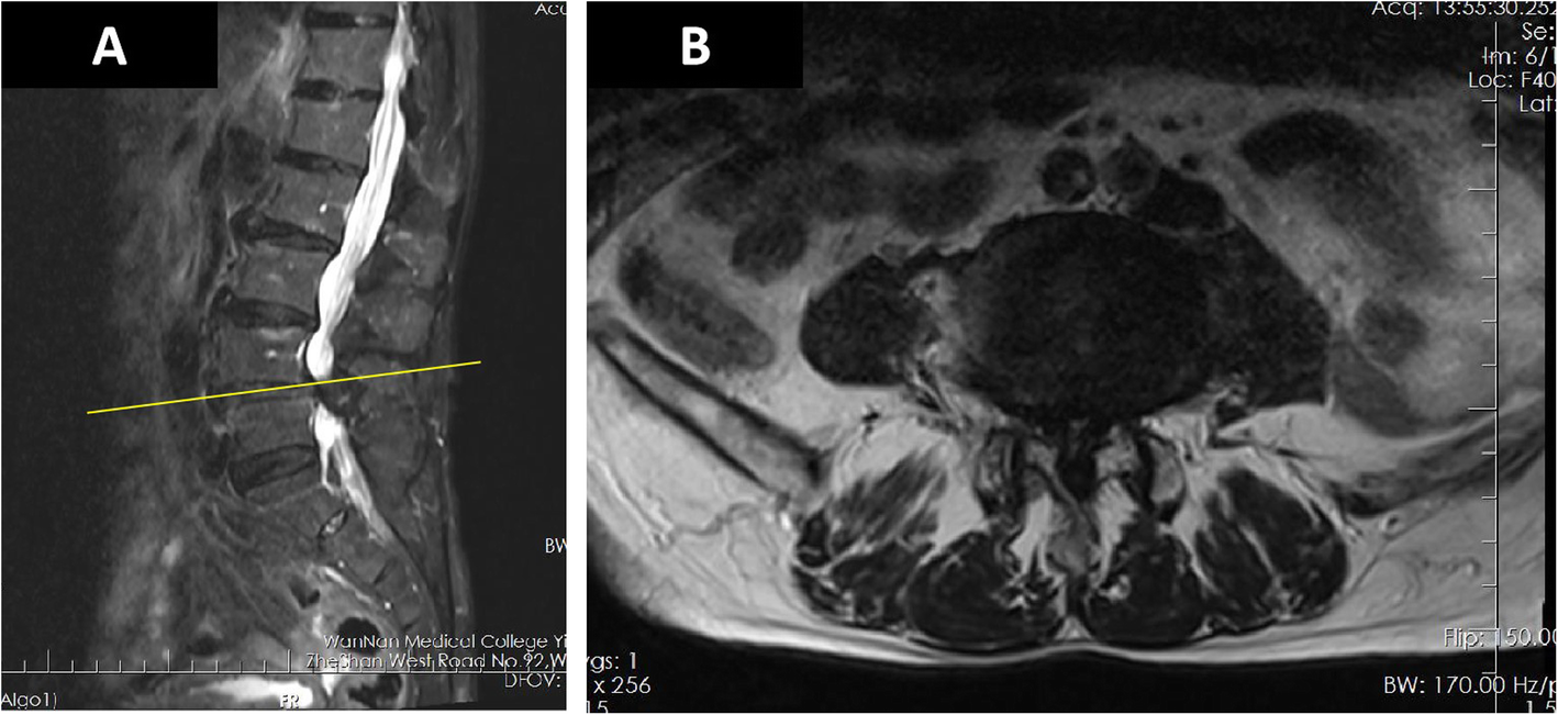 Fig. 1