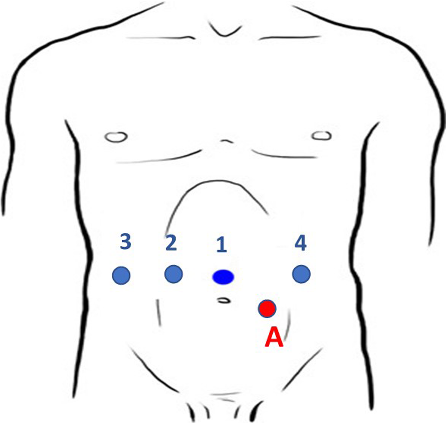 Fig. 3