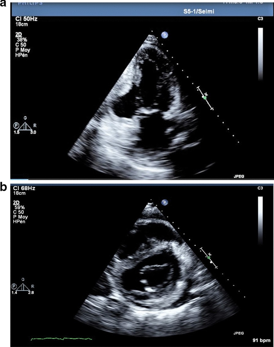 Fig. 2