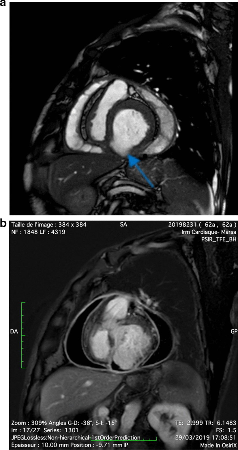 Fig. 4