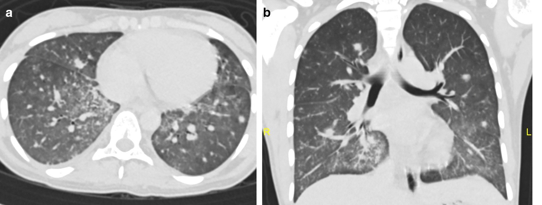 Fig.2