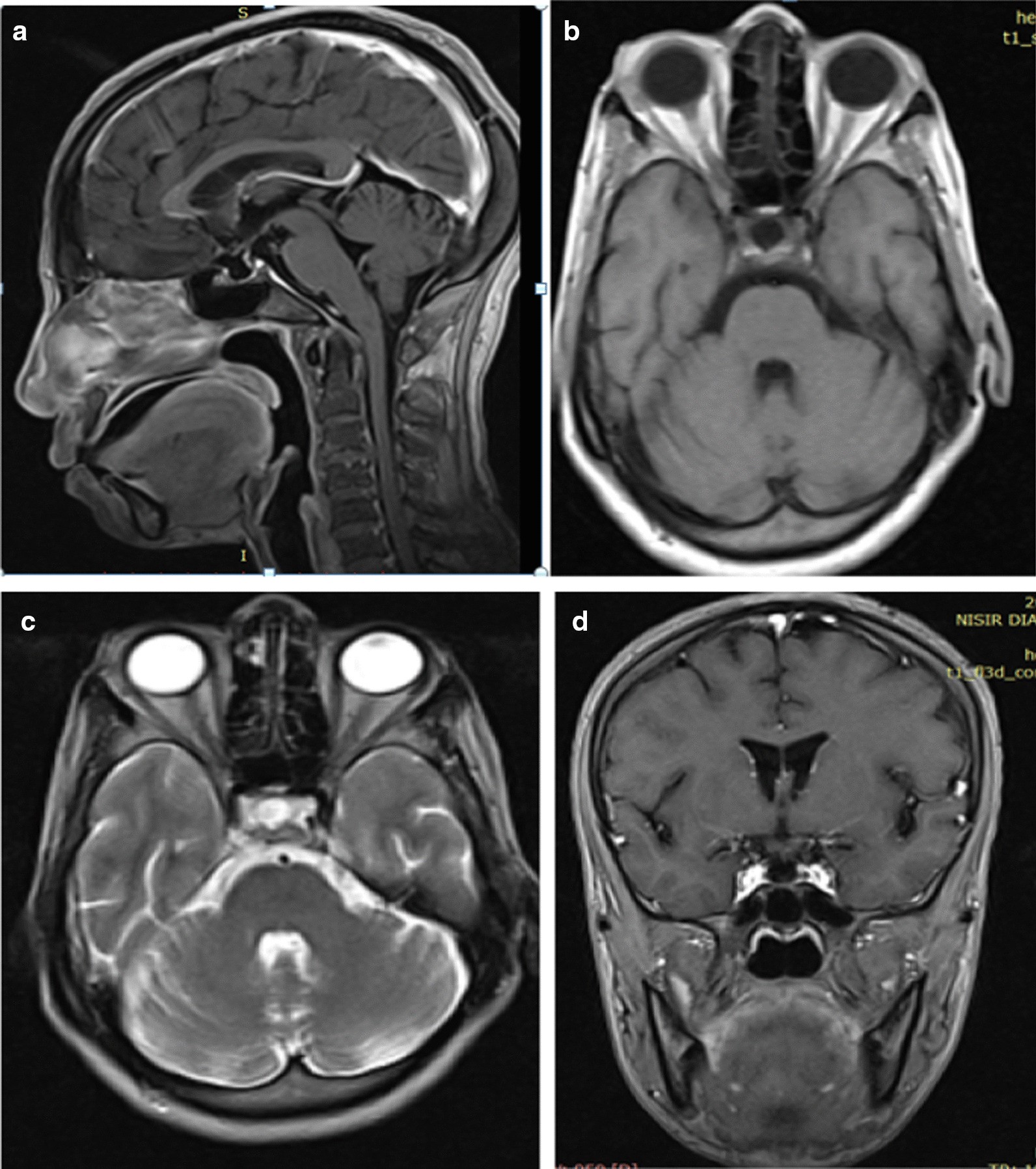 Fig. 1