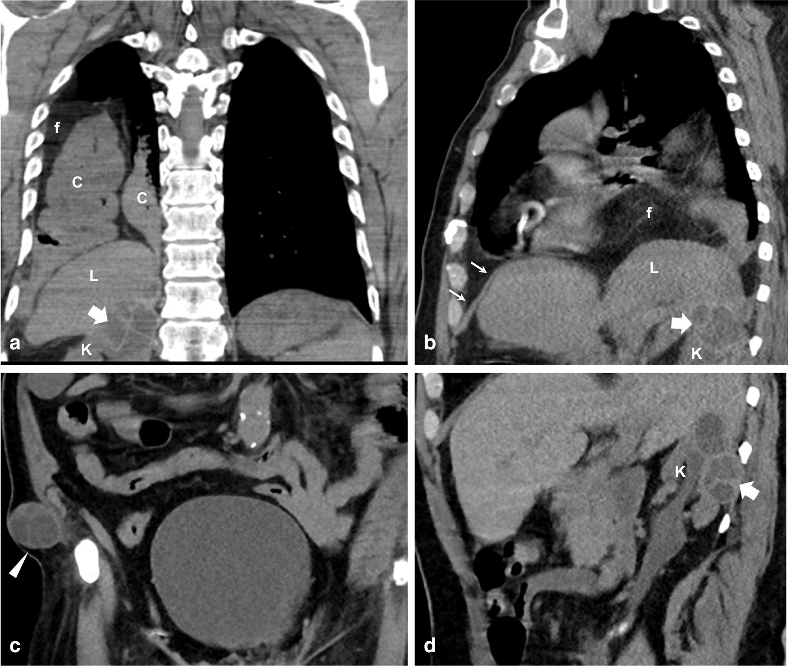 Fig. 2