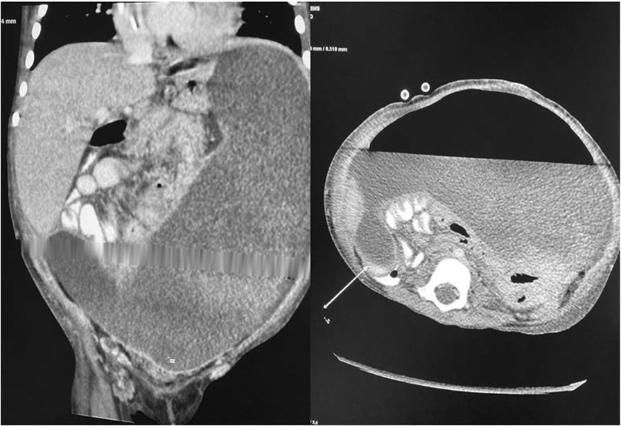 Fig. 1