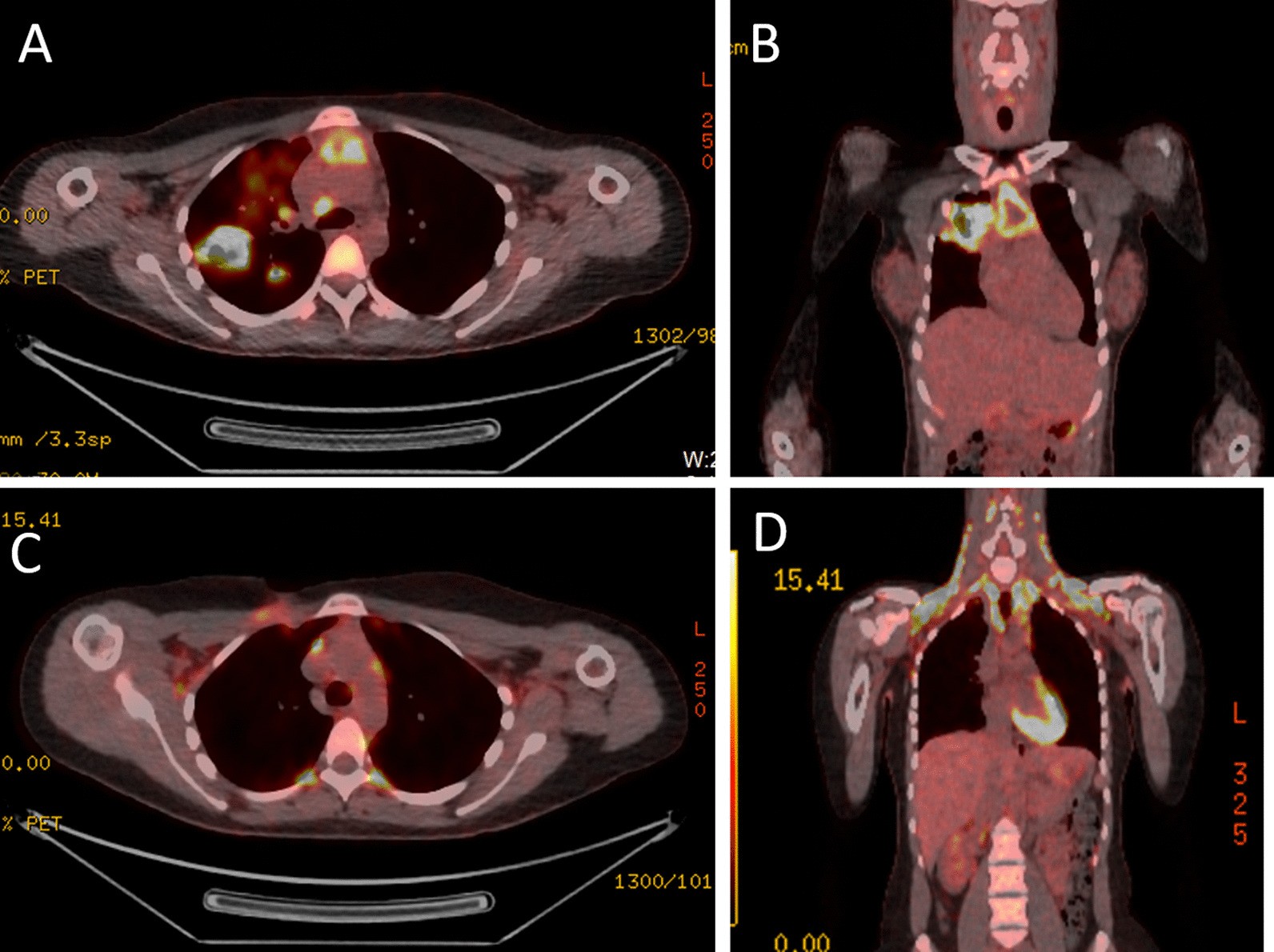 Fig. 4