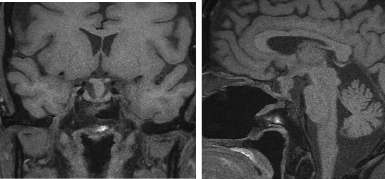 Fig. 7