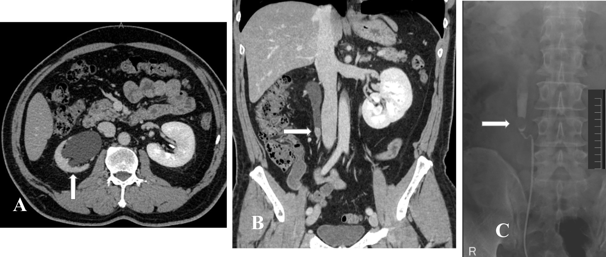 Fig. 1