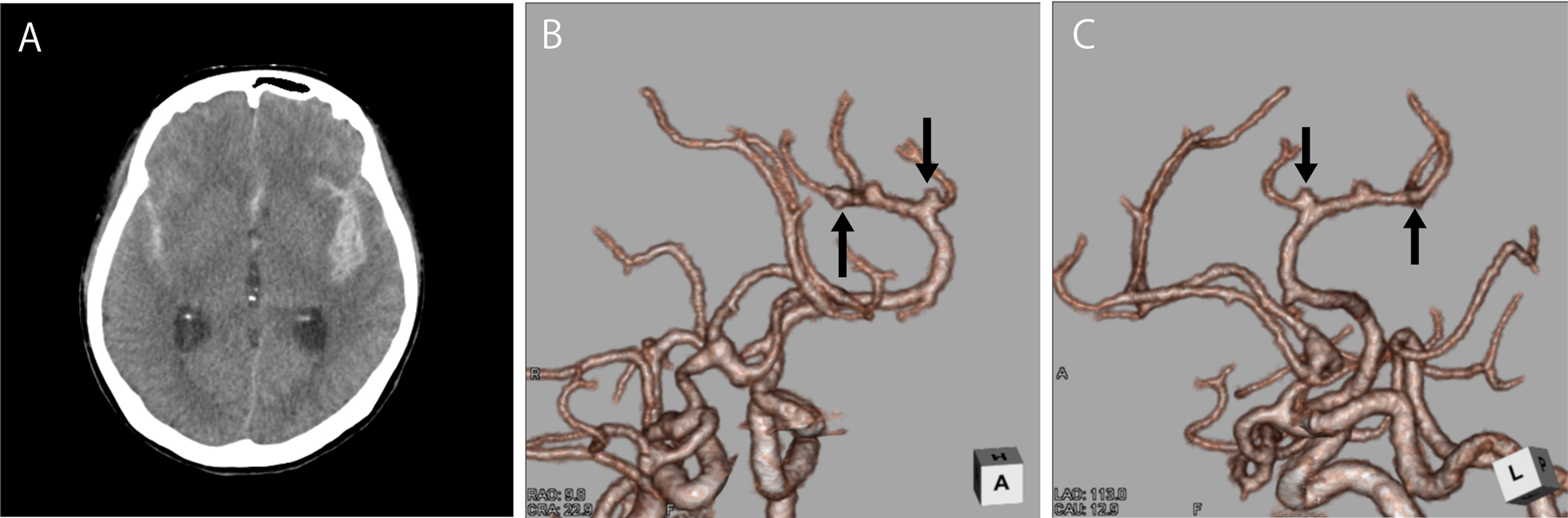 Fig. 2.