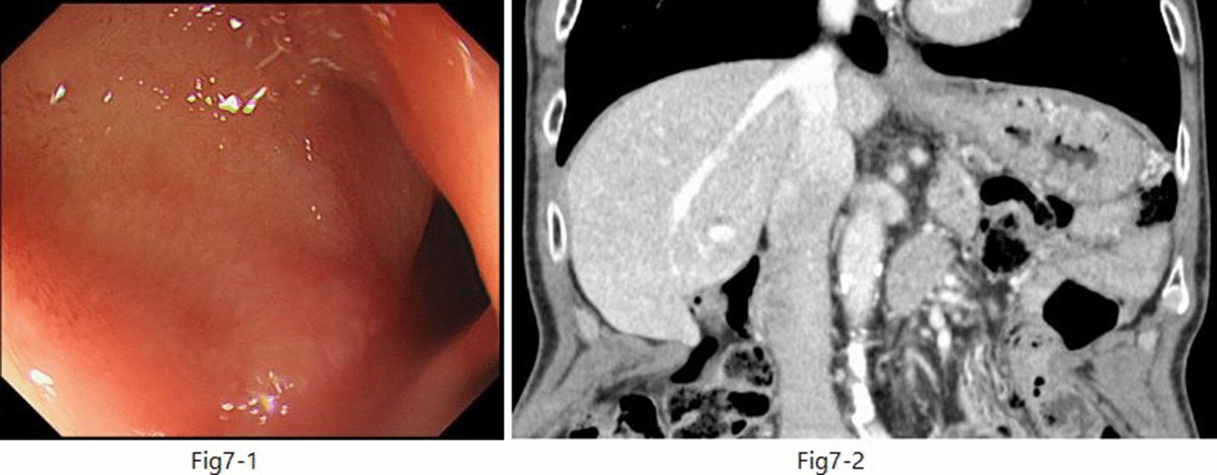 Fig. 7