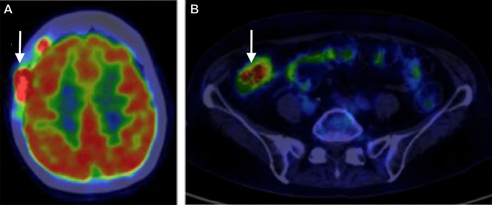 Fig. 2