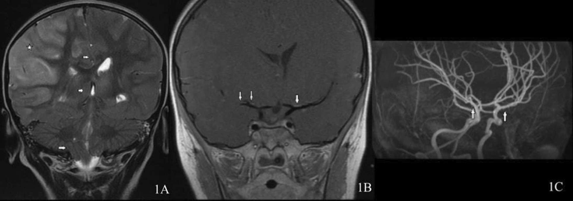 Fig. 1