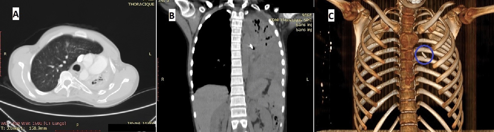 Fig. 1