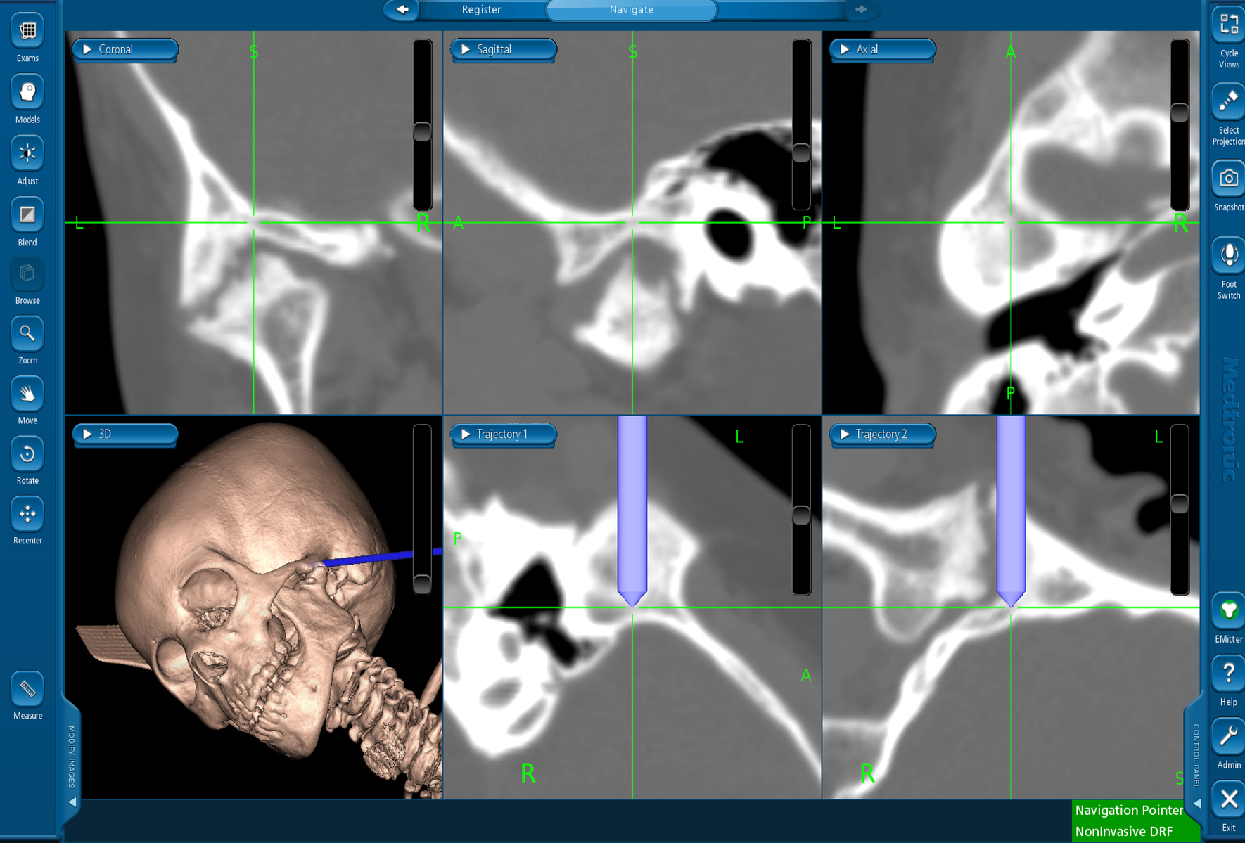 Fig. 4.