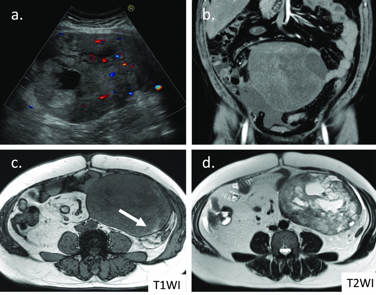 Fig. 1