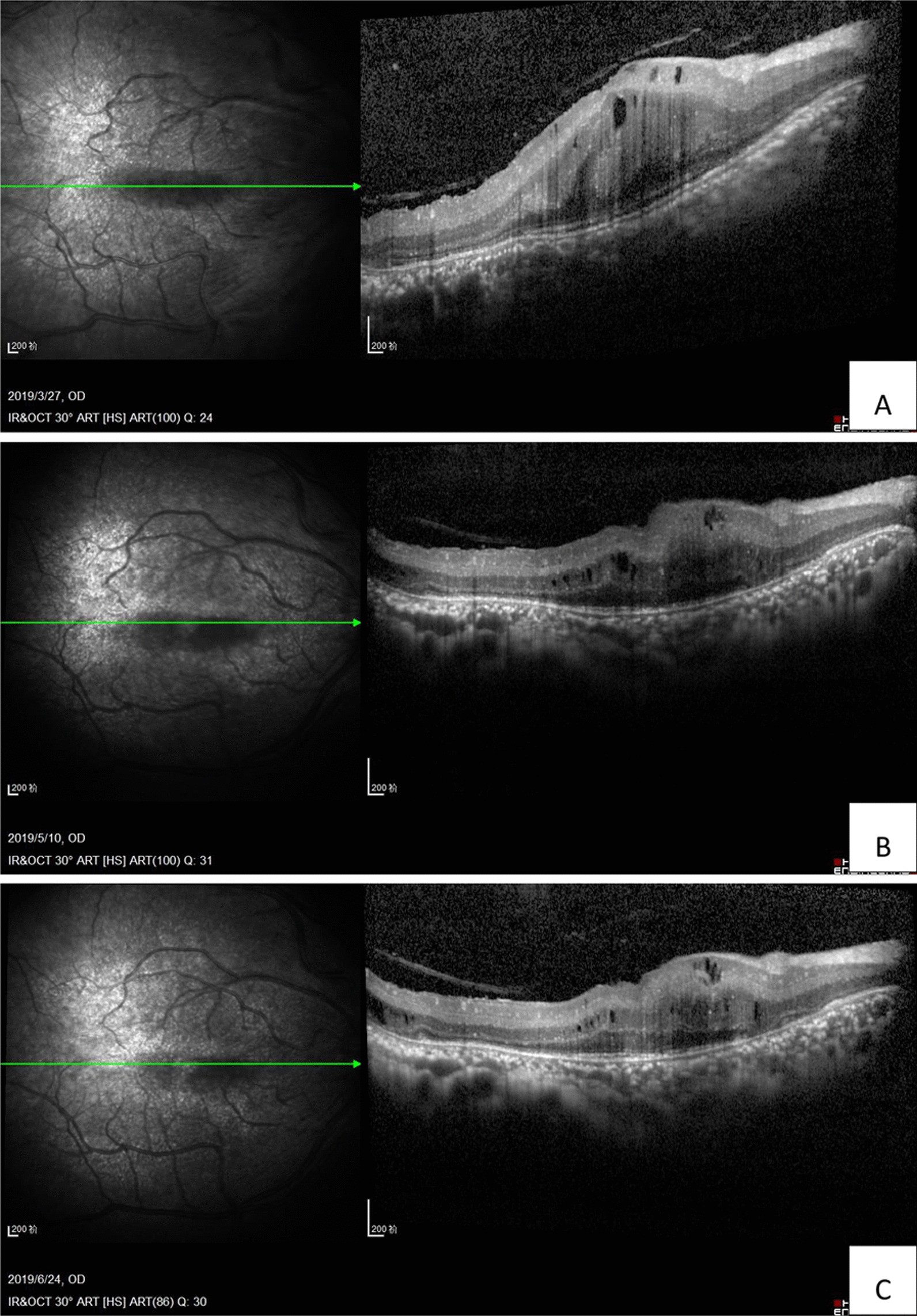 Fig. 4