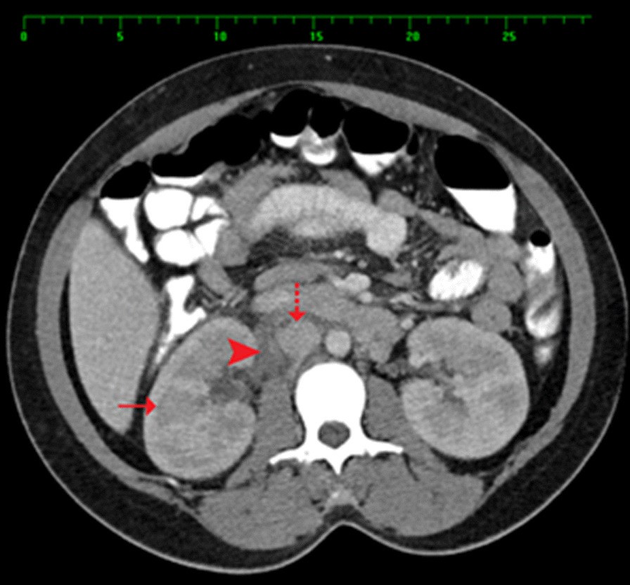 Fig. 4