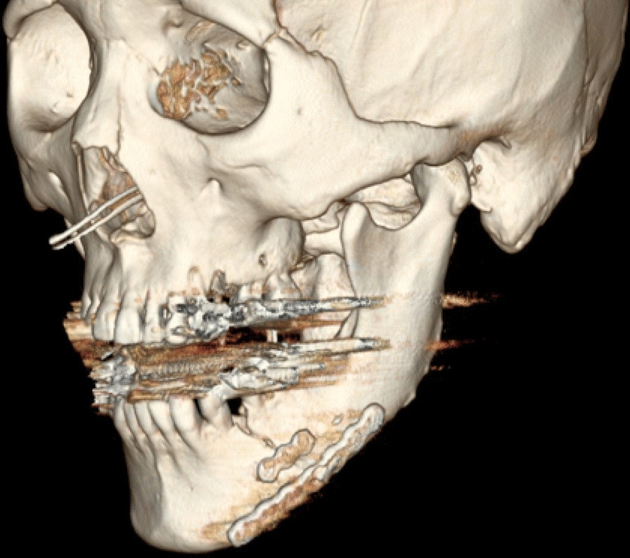 Fig. 7