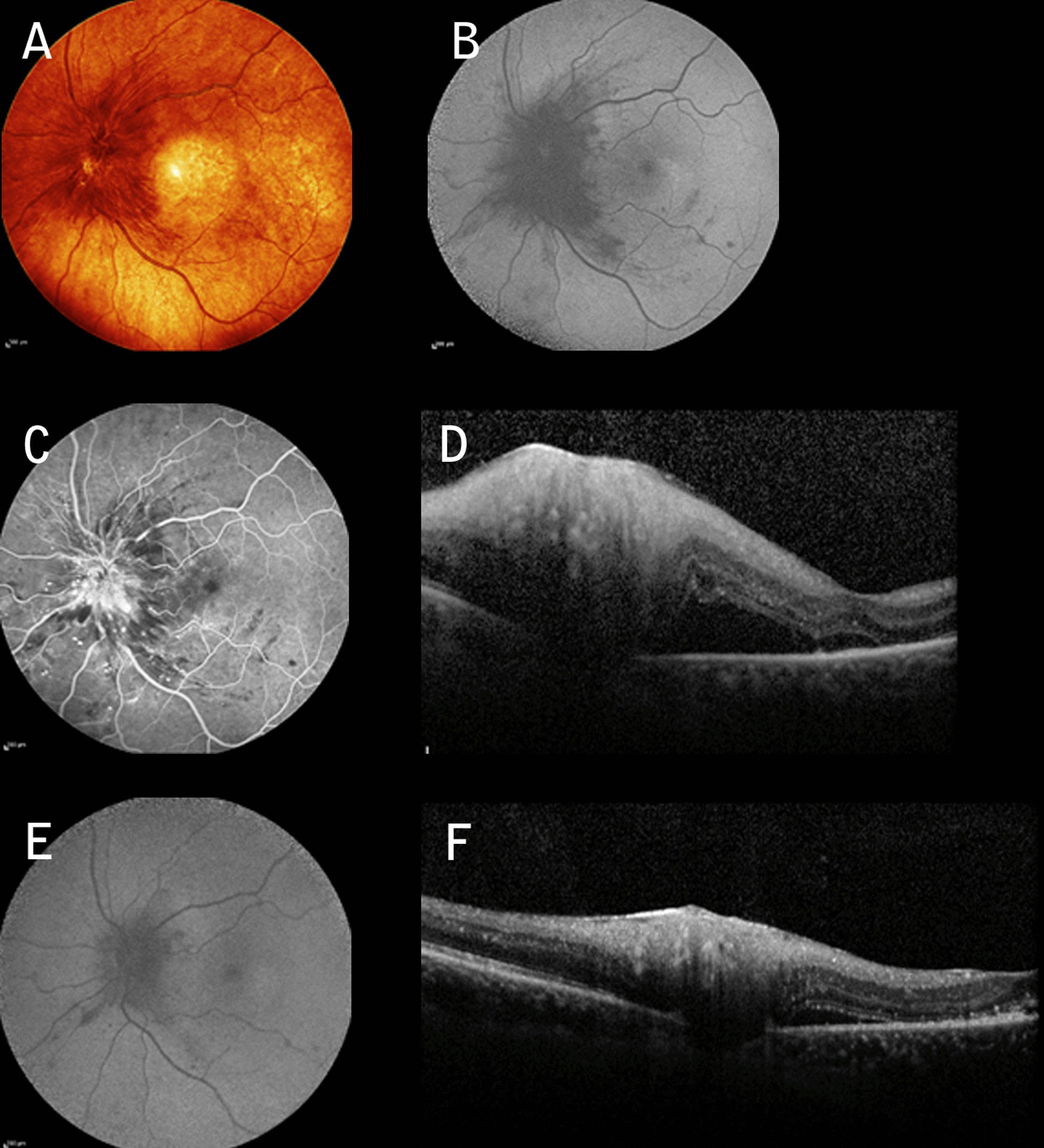 Fig. 3