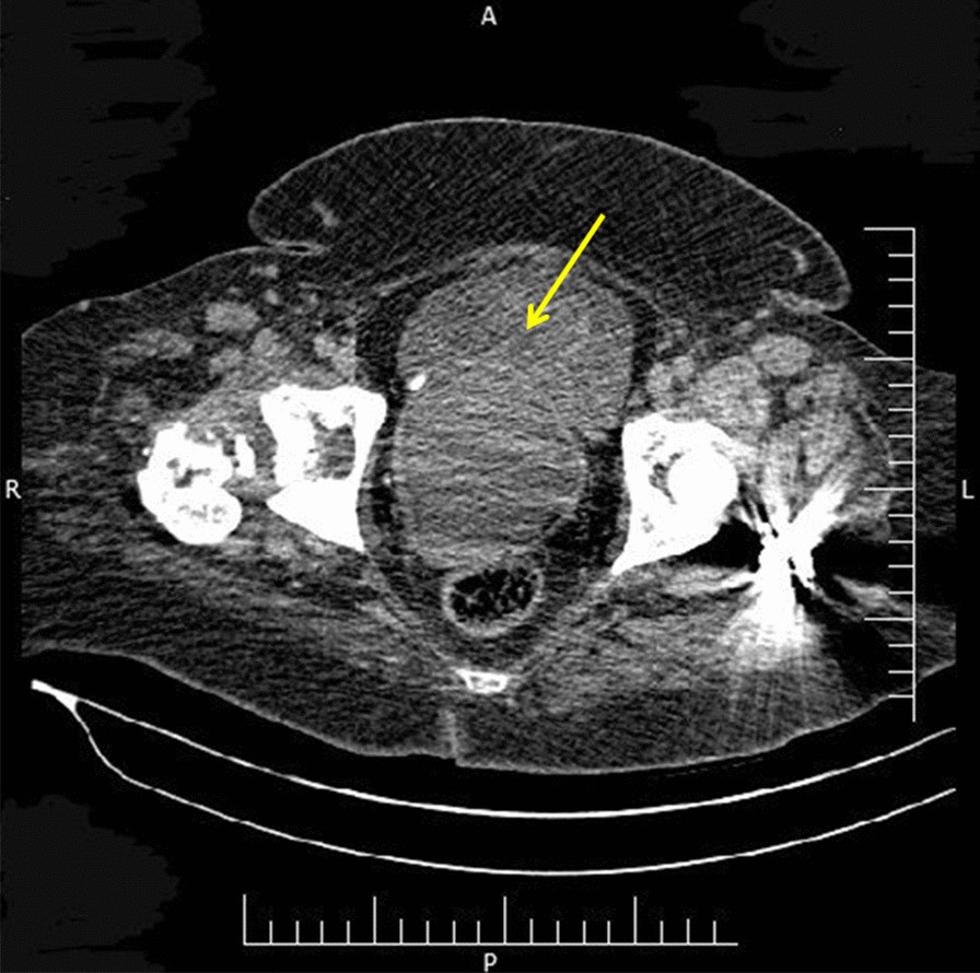 Fig. 1