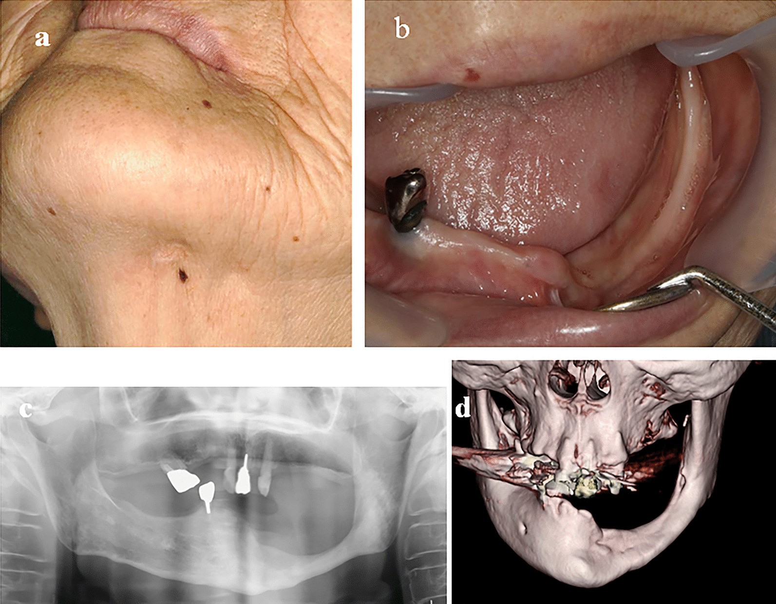 Fig. 3