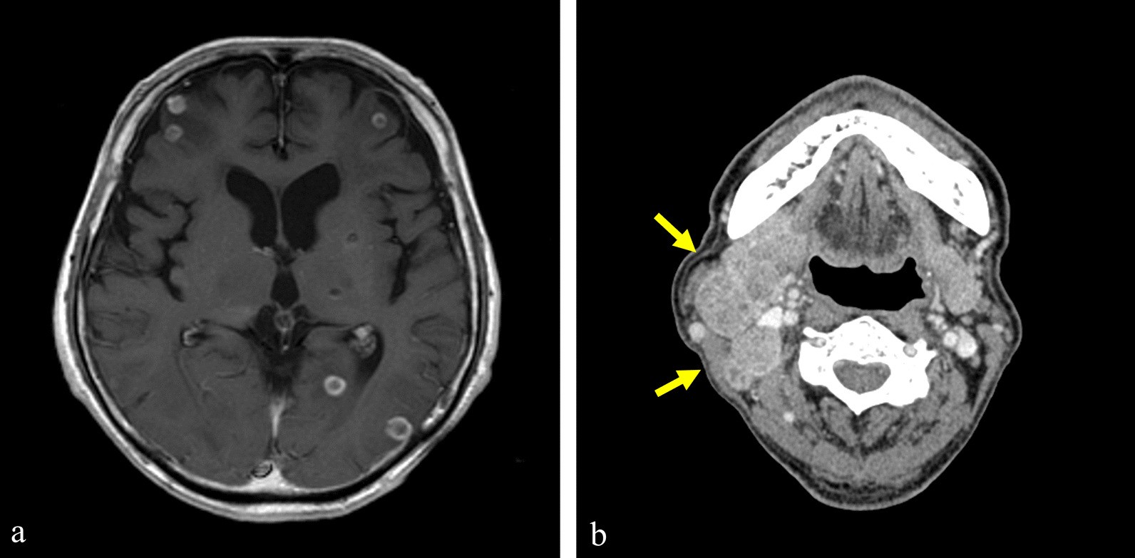 Fig. 11